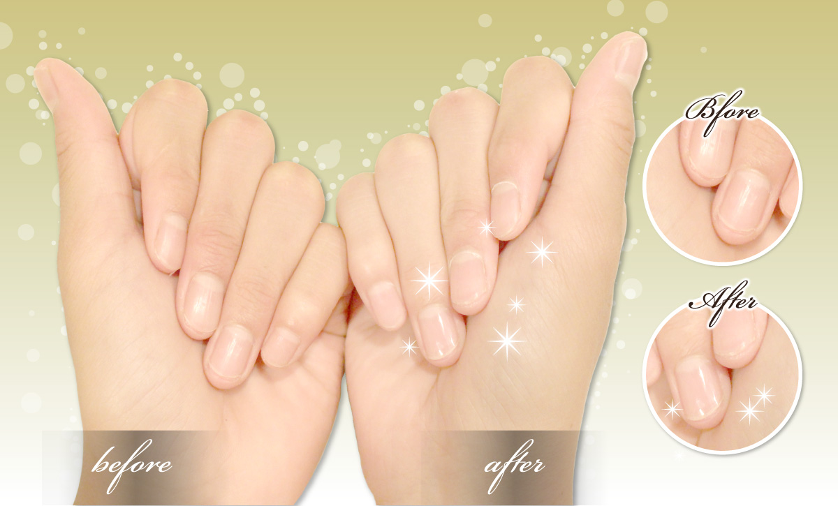 TUYAKO Cuticle Oil Set_image